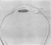 502