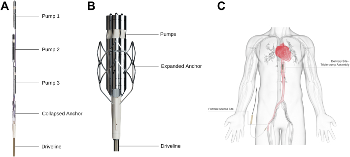 Figure 1