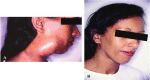 Fig. (10)