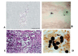 Fig. (1)