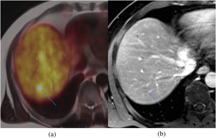 Figure 12.