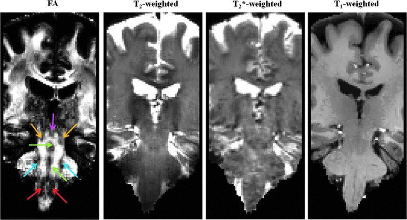 FIG. 1.