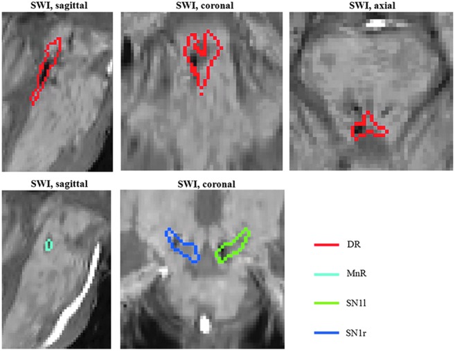 FIG. 7.