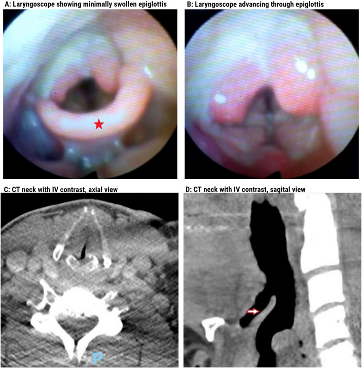 Figure 1