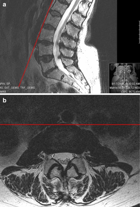 Fig. 1