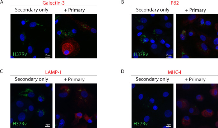 Figure 2—figure supplement 1.