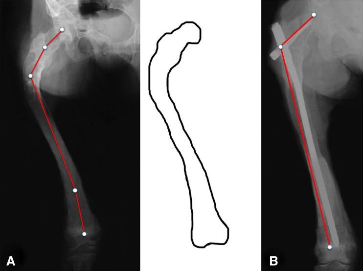 Fig. 5A–B