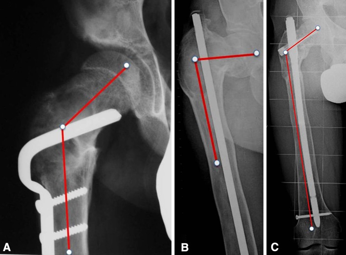 Fig. 11A–C