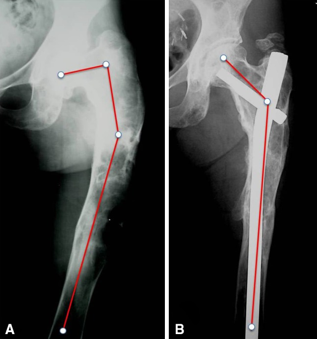 Fig. 10A–B