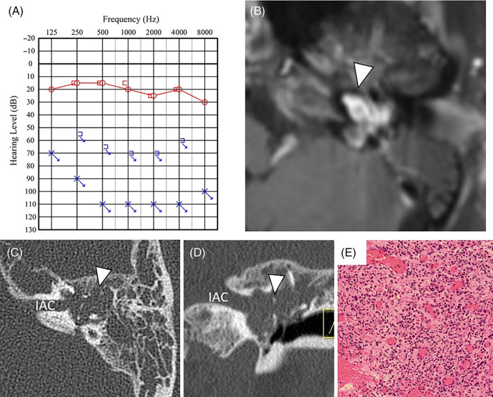 FIGURE 3