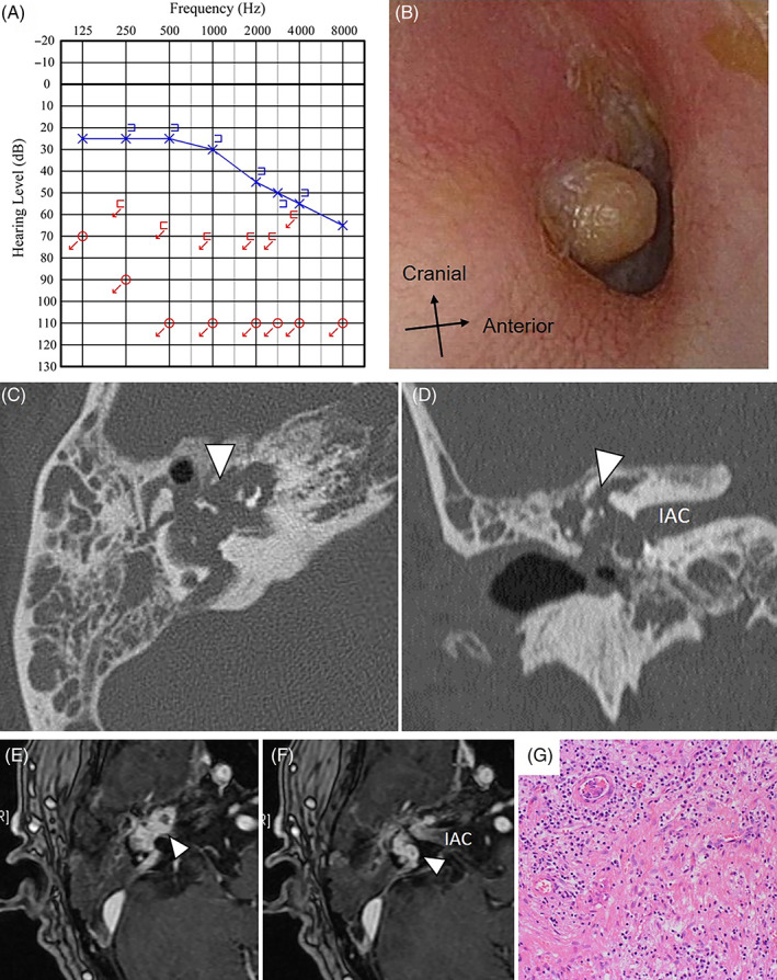 FIGURE 1