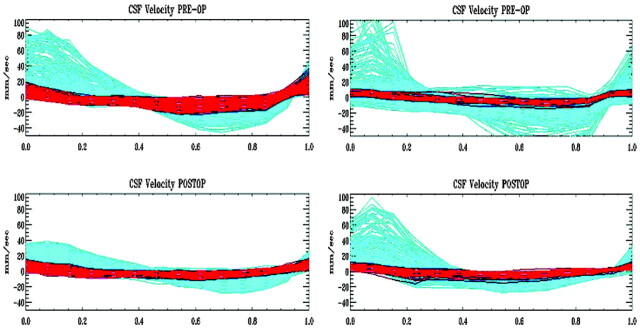 Fig 2.