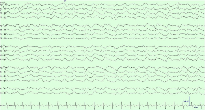 Fig. 1