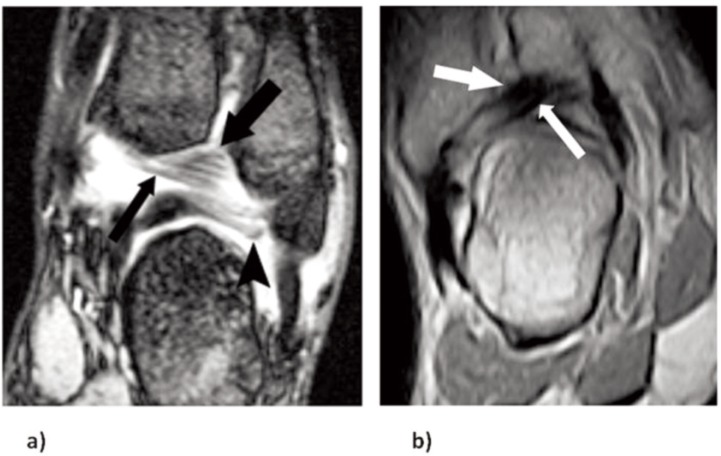 Figure 2 a–b.