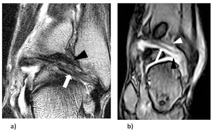 Figure 5 a–b.