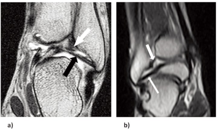 Figure 3 a–b.