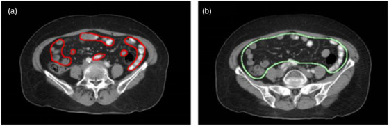 FIGURE 4