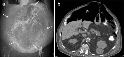 Fig. 5