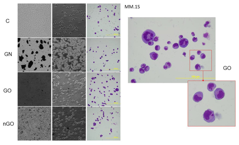 Figure 14