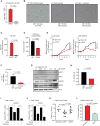 Figure 6. ACC1 selective inhibitors have activity in IDH1-mutated cancers. A, Viability of HT-1080 mIDH1 R132C cells after exposure to 4 μmol/L TOFA for 72 hours measured by DAPI-negative cell population. B, Representative images of wild-type IDH1 reversion HT-1080 cells cultured at low density in 4% lipid-depleted serum or IDH1 R132C parental cells or IDH1 R132C treated with 10 μmol/L ivosidenib. Note cells with IDH1 R132C mutation form ultra-thin adherent elongated spindle-like cells. This morphology changes were not reversed by coculture with ivosidenib. C, Measurement of 2HG in the supernatant of parental mIHD1 HT-1080 cells but undetectable in wild-type IDH1 reversion HT-1080 cells (clone #65 is shown as representative clone) after 72 hours. D, Total abundance of lysophospholipids (LPC + LPE) measured by LC-MS in mIDH1 vs. WT HT-1080 cultured in lipid-depleted media. E, Growth curves of mIDH1 vs. wild-type revertant HT-1080 in lipid-replete (left) vs. lipid-depleted (right) serum over 7 days. F, Fold change decrease in the number of live IDH1 R132C HT-1080 cells compared with IDH1 reversion wild-type HT-1080 cells after 96 hours exposure to ACC1 inhibitor TOFA compared with DMSO vehicle. Graph shows mean of 3 independent experiments. G, Western blot showing increased phosphorylated ACC1 Serine 79 after treatment of HT-1080 wild-type cells with increasing concentration of 5-aminoimidazole-4-carboxamide riboside (AICAR). H, Fold change decrease of in the number of live IDH1 R132C HT-1080 cells after 96 hours exposure AICAR vs. to H2O vehicle in comparison with IDH1 reversion wild-type HT-1080 cells under same conditions. Graph is a summary of 3-independent experiments. I–J, Primary mIDH1 AML cells isolated by flow cytometry from a patient at relapse (I) and a de novo patient (J) are sensitive to 10 μmol/L TOFA over 72 hours but cytotoxicity is not reversed by 10 μmol/L ivosidenib. K, Summary of TOFA IC50 at 72 hours after in vitro treatment of mIDH1, mIDH2, and IDH wild-type primary AML blasts cultured in low serum media. P value reflects nonparametric two-tailed comparison between groups; bars represent median IC50 in μmol/L. L, Engraftment of mIDH1 AML at baseline and after 30 days of treatment with either vehicle or 50 mg/kg TOFA given by daily intraperitoneal injection. P = 0.007, paired t test, treated vs. baseline.