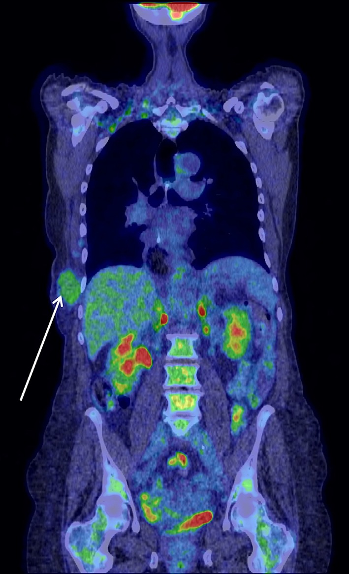 Fig. 4