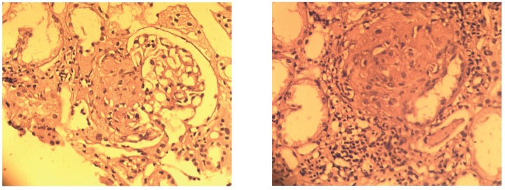 Figure3A, 3B