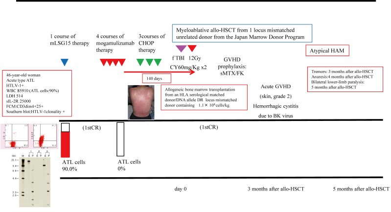 Fig. 1A