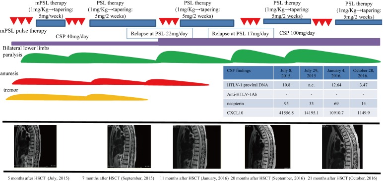 Fig. 1B