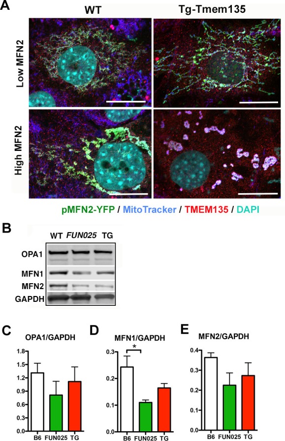 Figure 5—figure supplement 2.