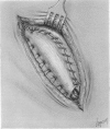 235