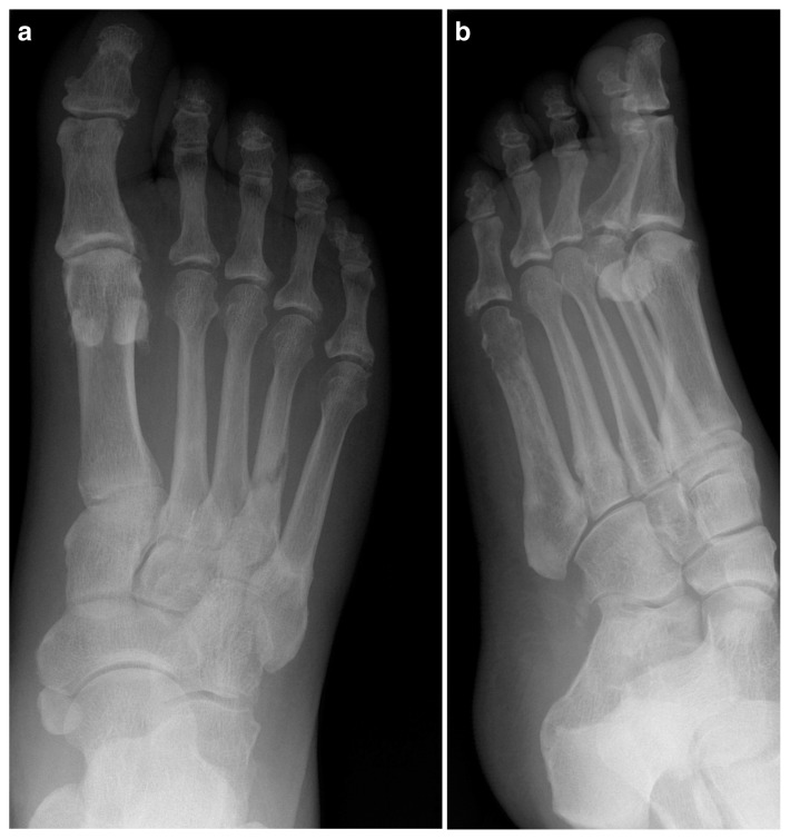 Figure 4 a, b