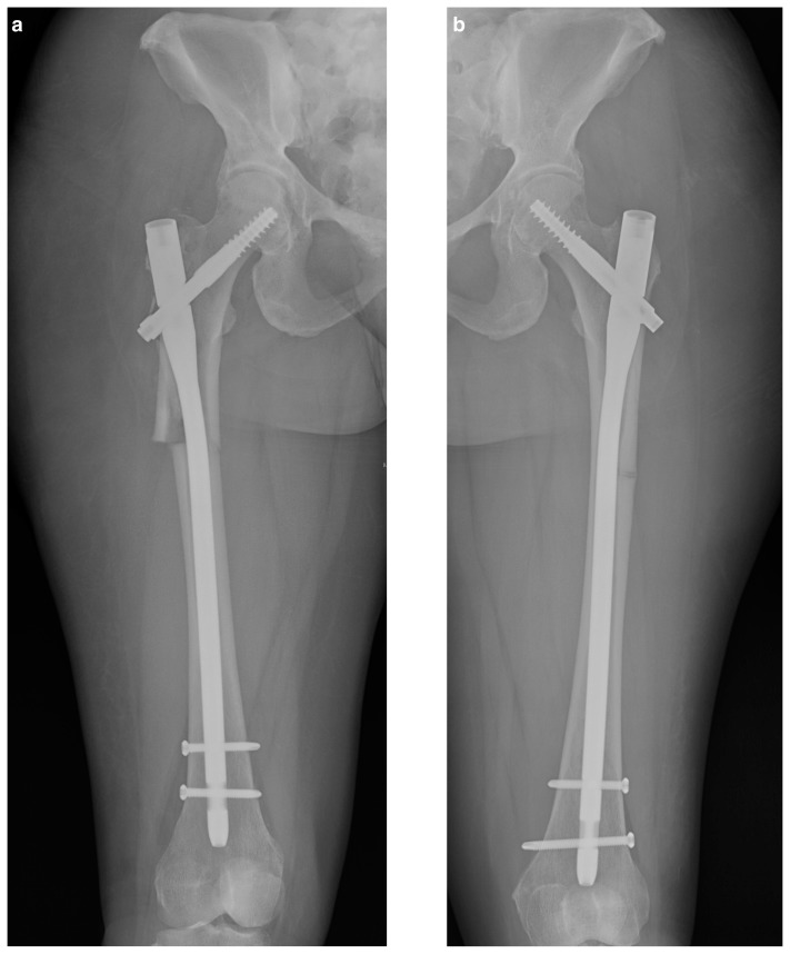 Figure 2 a, b