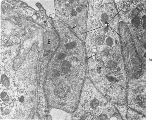 Fig. 10