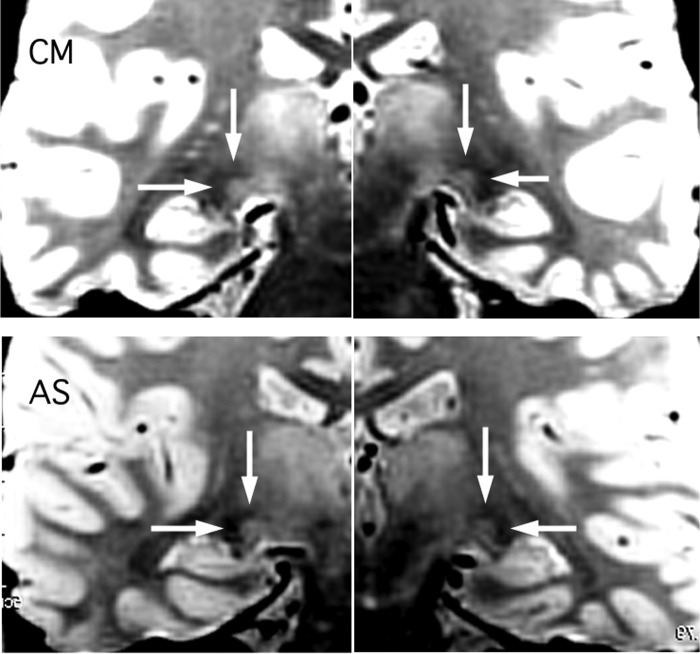 FIG. 5.