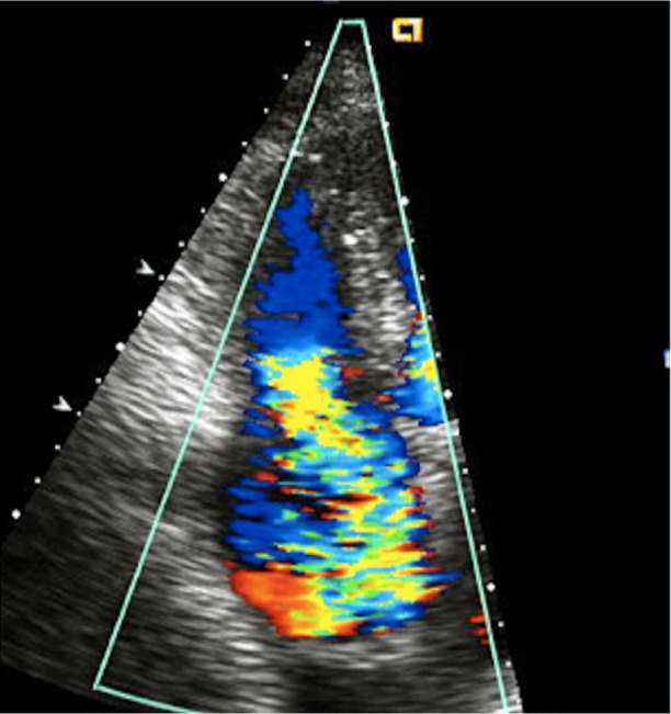 Fig. 2.