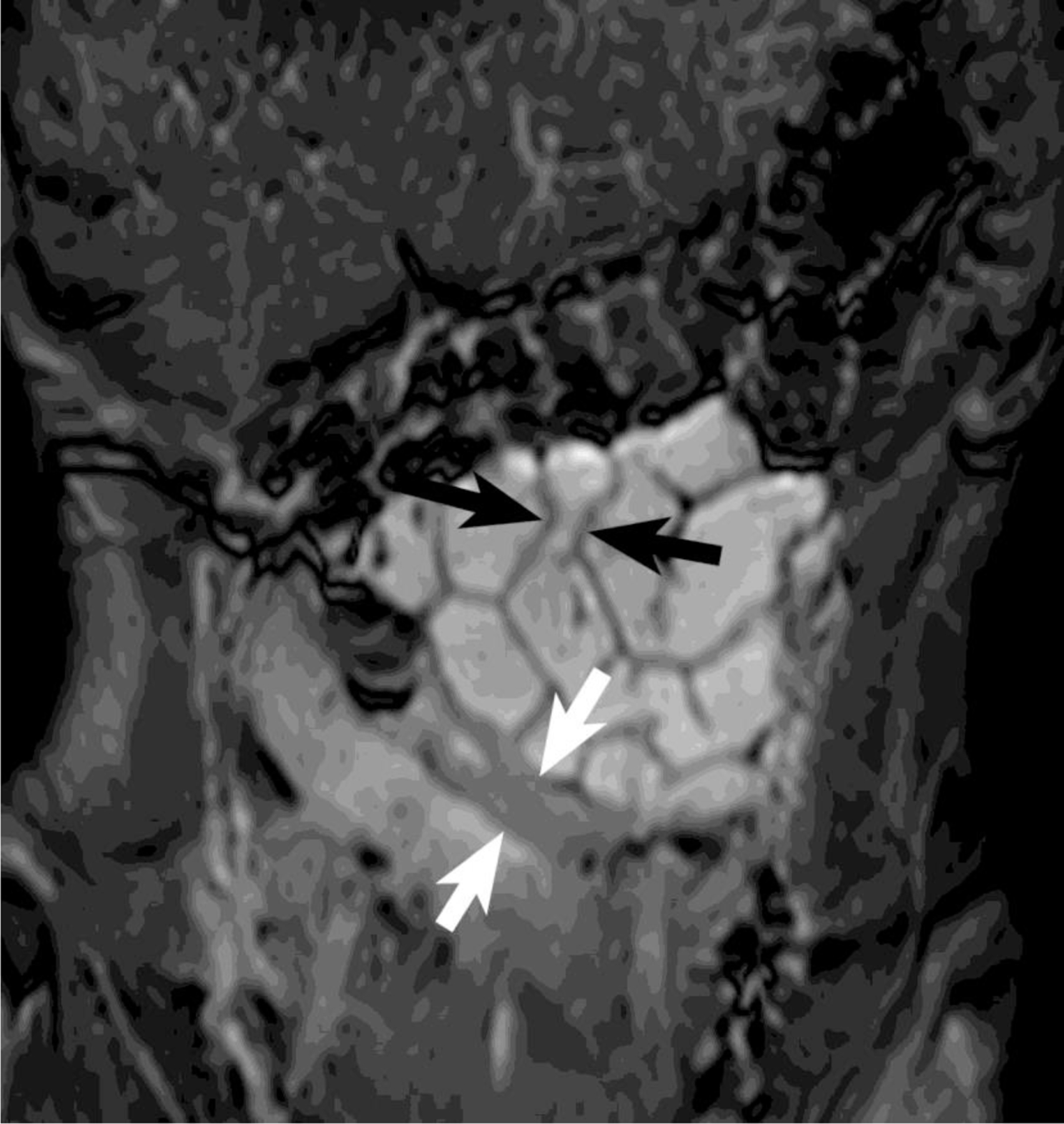 FIGURE 2A: