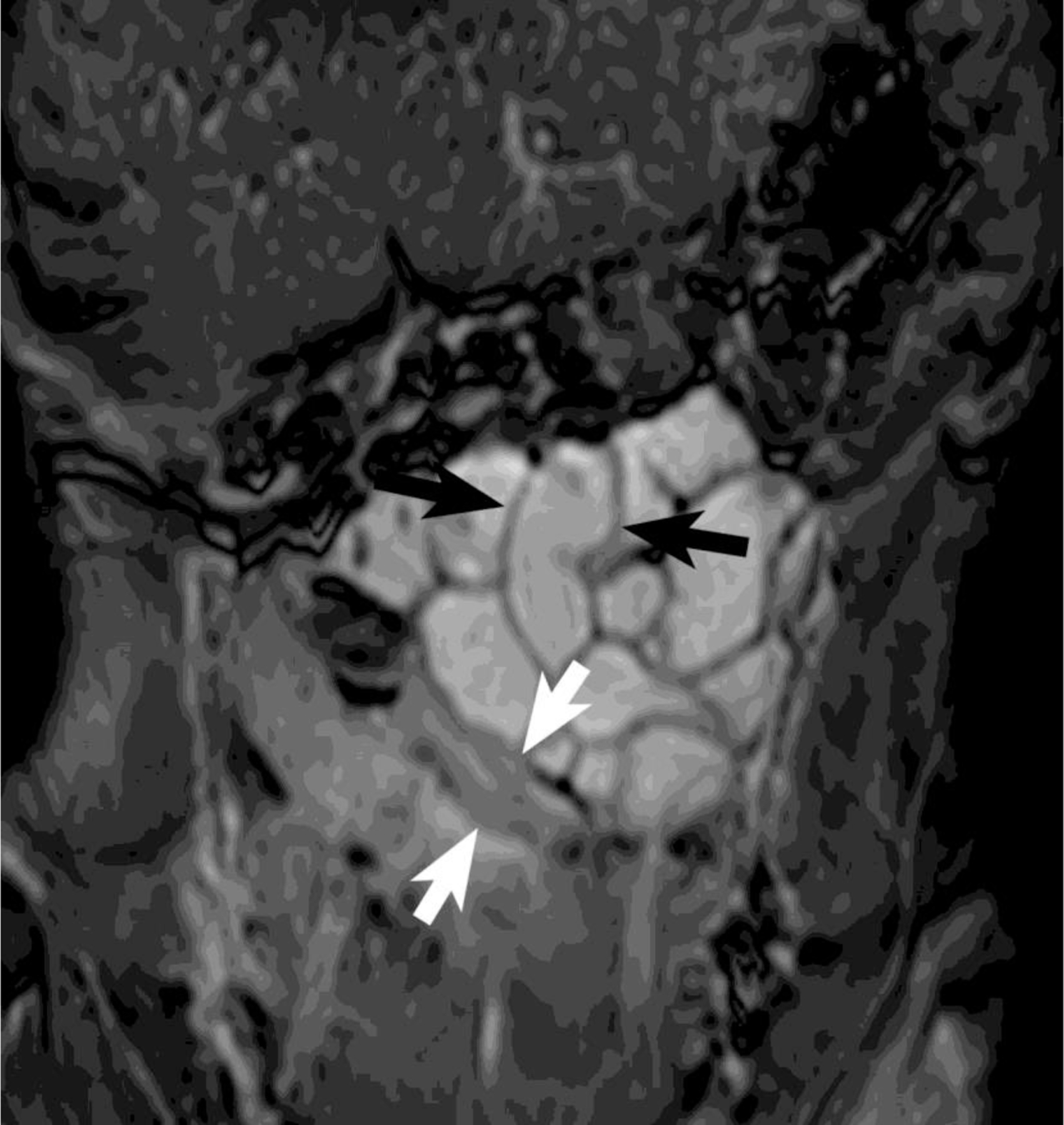 FIGURE 2B: