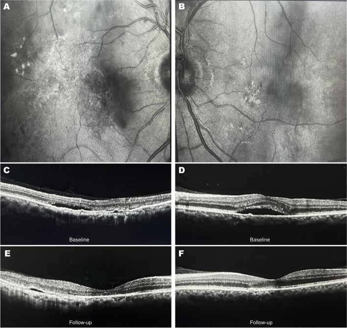 Fig. 1