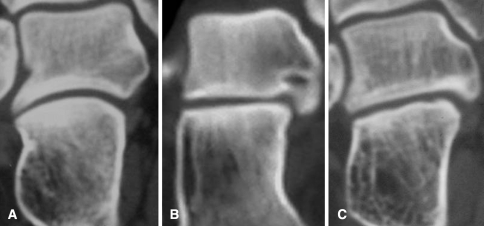 Fig. 4A–C