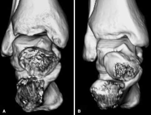 Fig. 3A–B