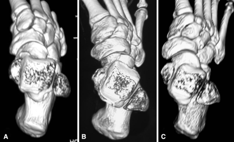 Fig. 1A–C