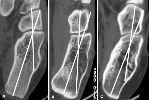 Fig. 2A–C