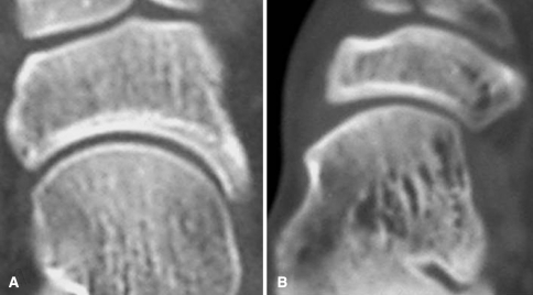 Fig. 5A–B