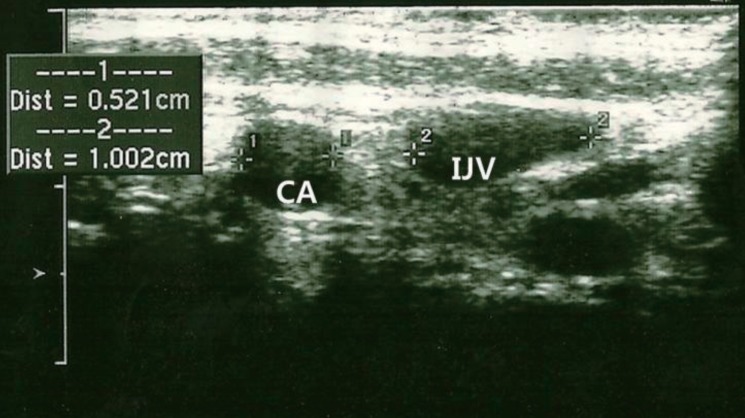 Fig. 1