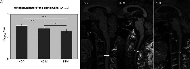 FIG 3.