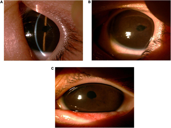 FIGURE 3