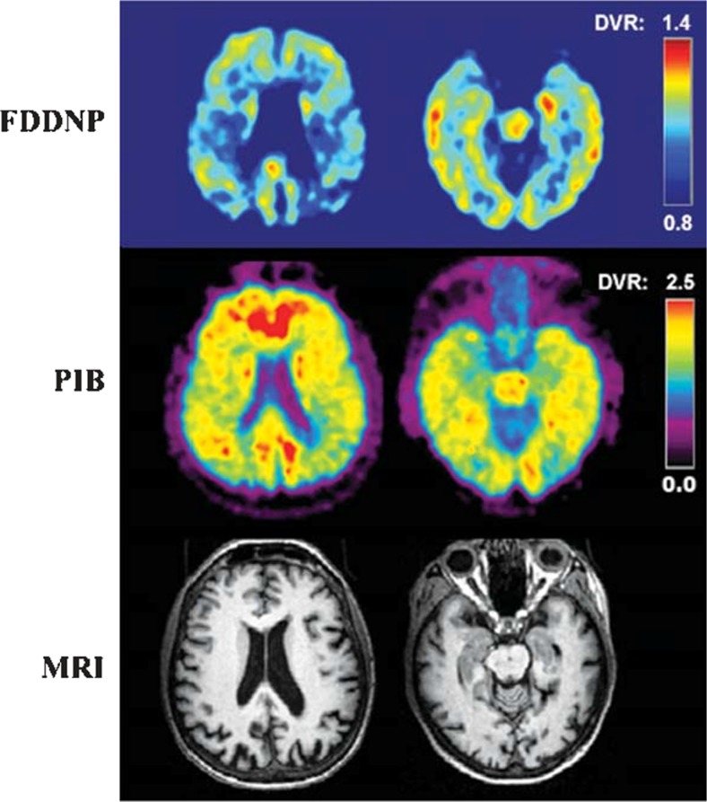 Fig. 2