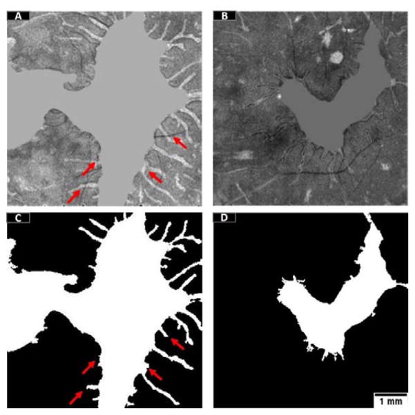 Figure 11