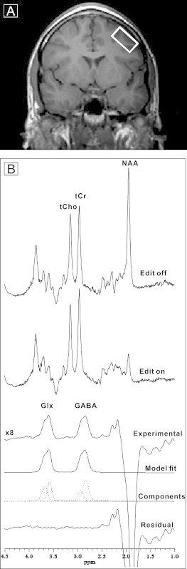 Fig. 1