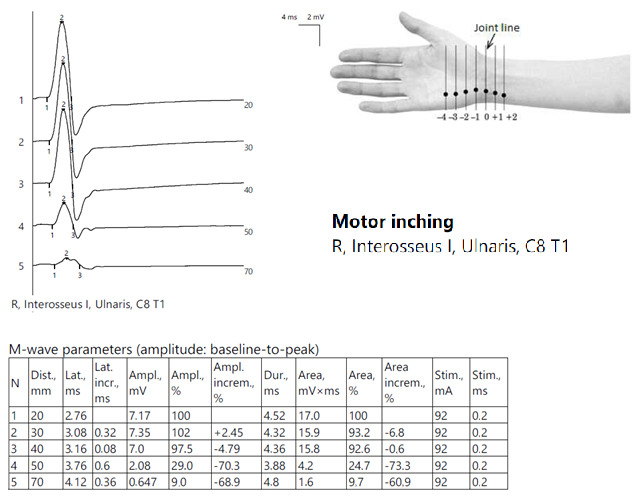 Figure 10